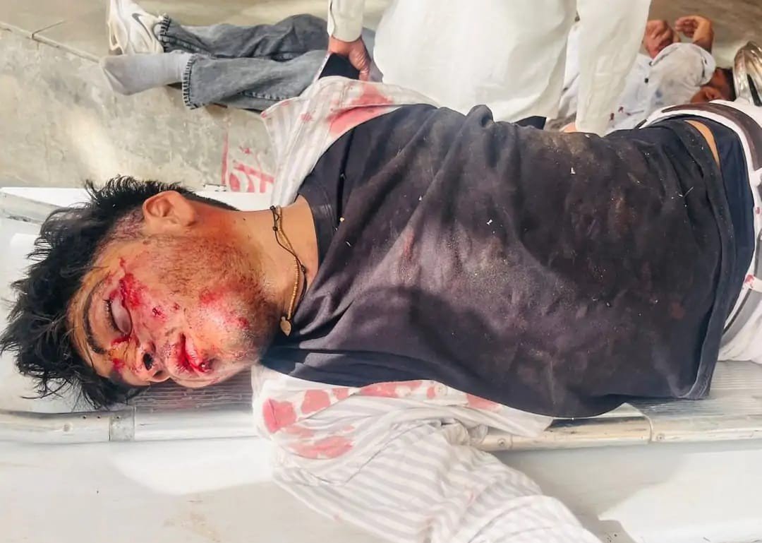 फतेहपुर सीकरी हाईवे पर भीषण सड़क हादसा, महिला समेत तीन घायल
